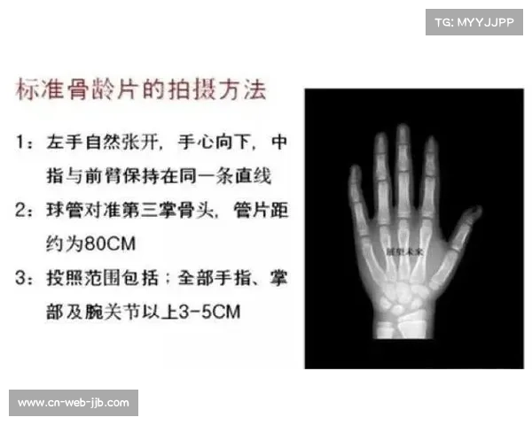 古典跤年龄造假调查揭示省级赛骨龄检测误差超国际标准2.4个百分点 古典跤年龄造假调查揭示省级赛骨龄检测误差超国际标准2.4个百分点